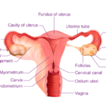 Fallopian tube cancer,