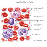 Blood cancer