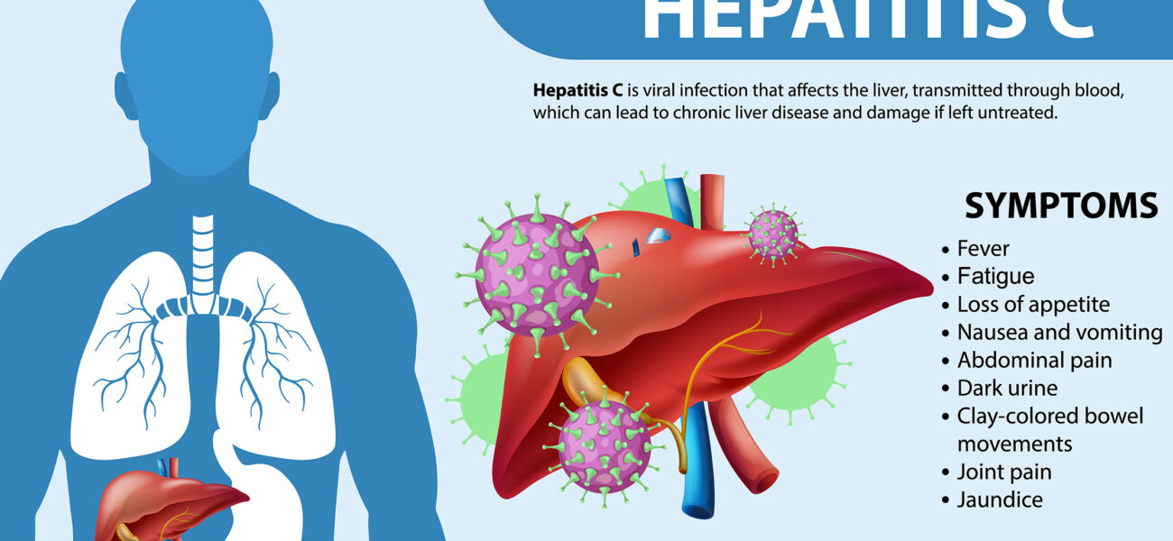 Hepatitis C