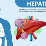 Hepatitis C