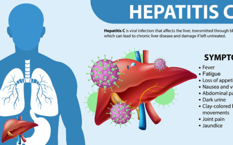 Hepatitis C