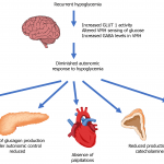 Hypoglycemia