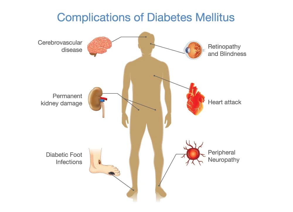 What is Type 2 diabetes? - MEDICINE FOR WORLD