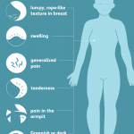 Fibrocystic breast disease