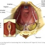 idiopathic constipation