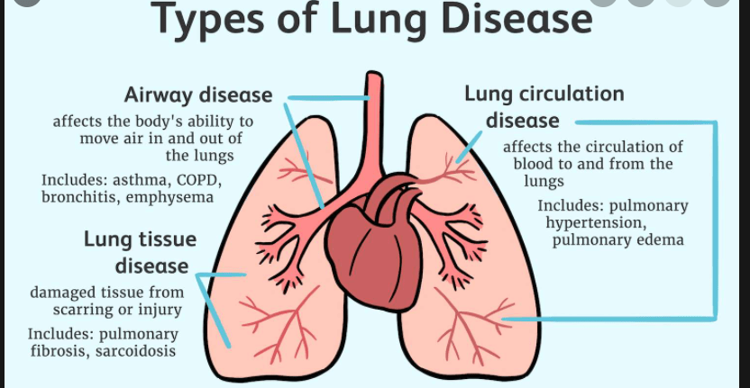 Lung diseases