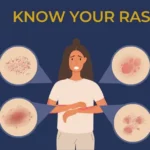 Rashes: Causes, Symptoms, Diagnosis, Treatment, and Prevention