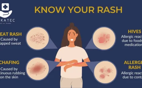 Rashes: Causes, Symptoms, Diagnosis, Treatment, and Prevention