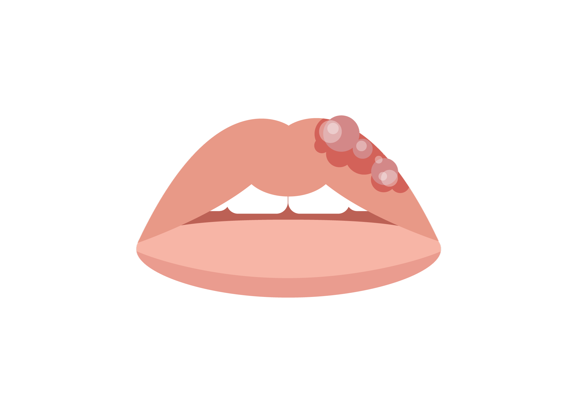 Swelling of Lips Causes, Symptoms, and Treatment