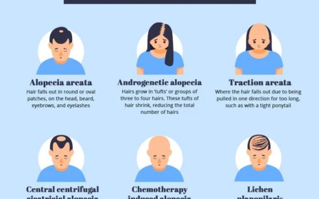 Alopecia Areata