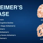 What is Alzheimer?