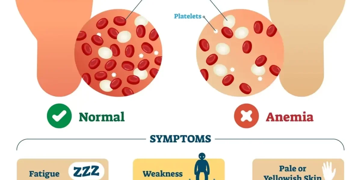 What is Anemia?