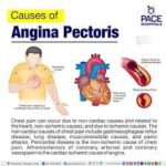 What is Angina Pectoris?