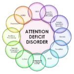 What is Attention-Deficit?