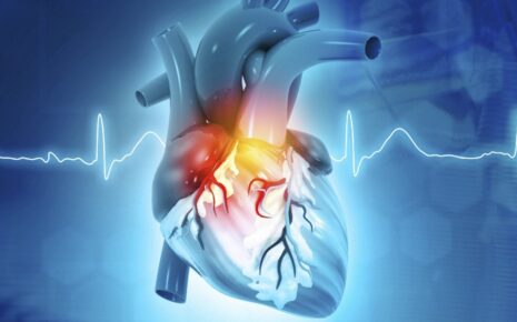 What is Cardiovascular Disease?