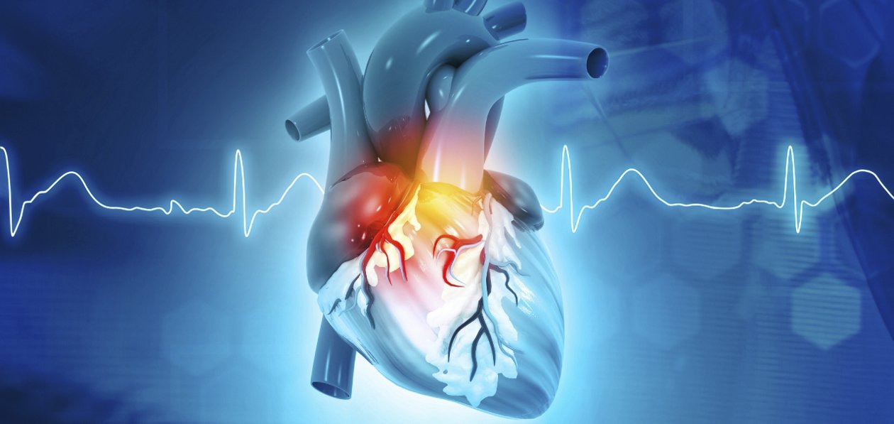 What is Cardiovascular Disease?