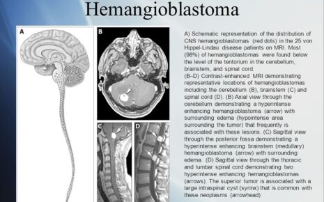 What is Central Nervous System Hemangioblastomas?