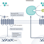 What is Cholestatic Pruritis?