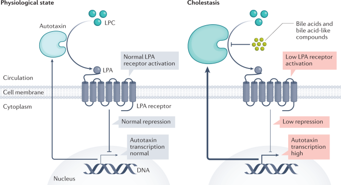 What is Cholestatic Pruritis?