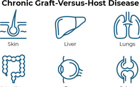 Chronic Graft-Versus-Host Disease (cGVHD)