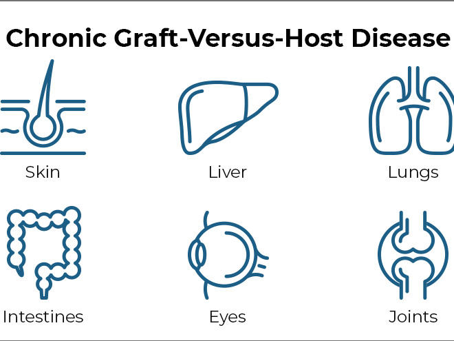 Chronic Graft-Versus-Host Disease (cGVHD)