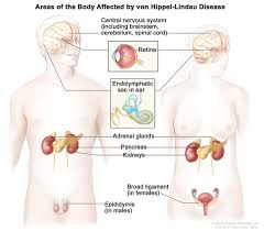 Von Hippel-Lindau Disease