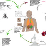 What is Trypanosomiasis