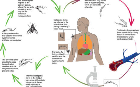 What is Trypanosomiasis