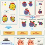 What is Diabetic Dyslipidemia