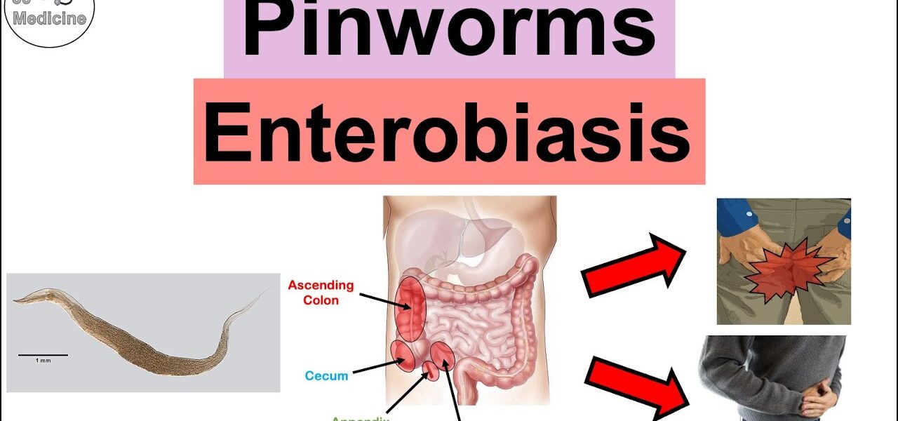 What is Enterobiasis
