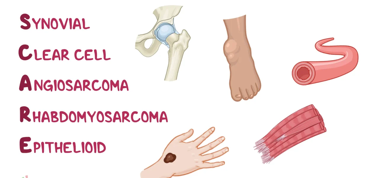 What is Epithelioid Sarcoma