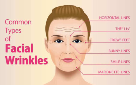What is Facial Wrinkles