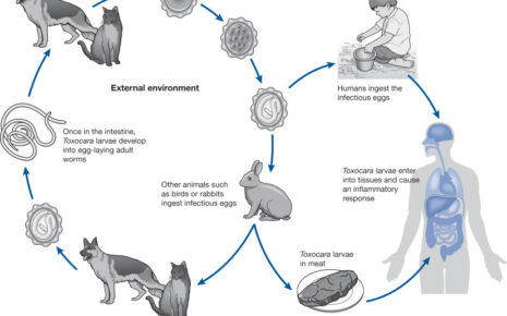 What is Toxocariasis?