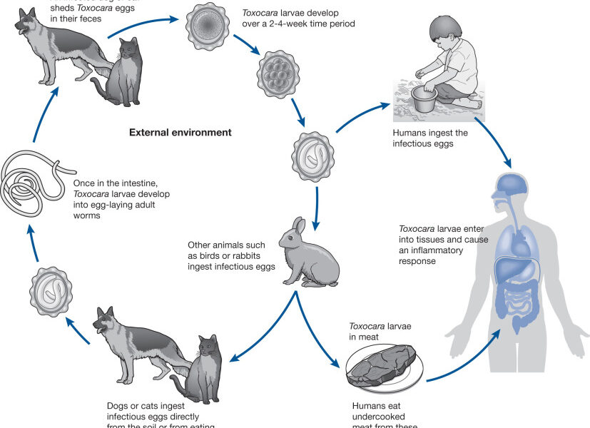 What is Toxocariasis?