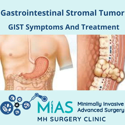 What is a Gastrointestinal Stromal Tumor