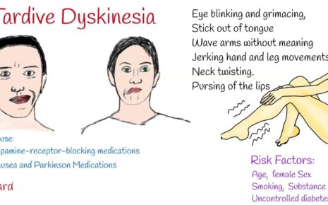 What is Tardive Dyskinesia