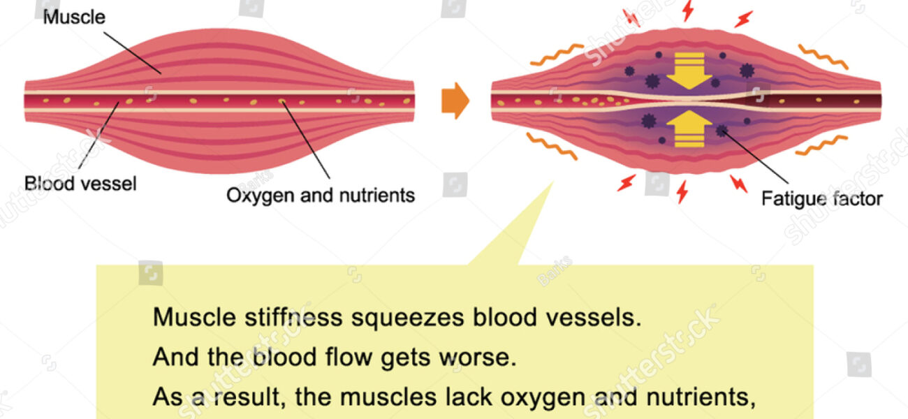 What is Stiffness