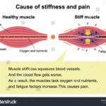 What is Stiffness
