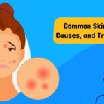 What Is a Skin Rash