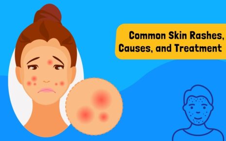 What Is a Skin Rash