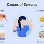What is Seizures