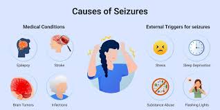 What is Seizures