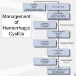 What is Hemorrhagic Cystitis