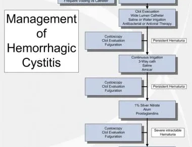 What is Hemorrhagic Cystitis