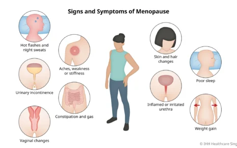 What is Menopause
