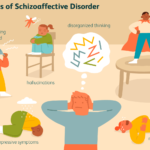 Schizoaffective Disorder