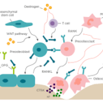 Postmenopausal Osteoporosis