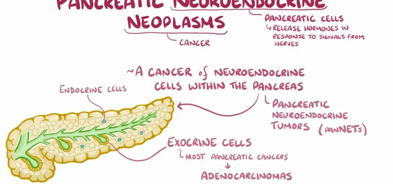 Pancreatic Neuroendocrine Tumors