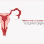 Ovarian Failure