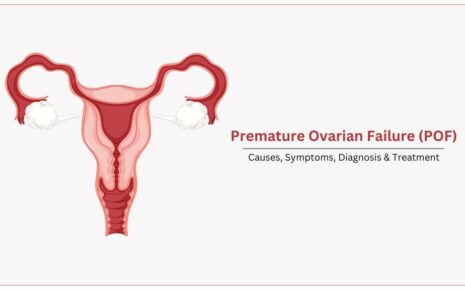 Ovarian Failure